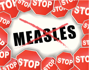 measles